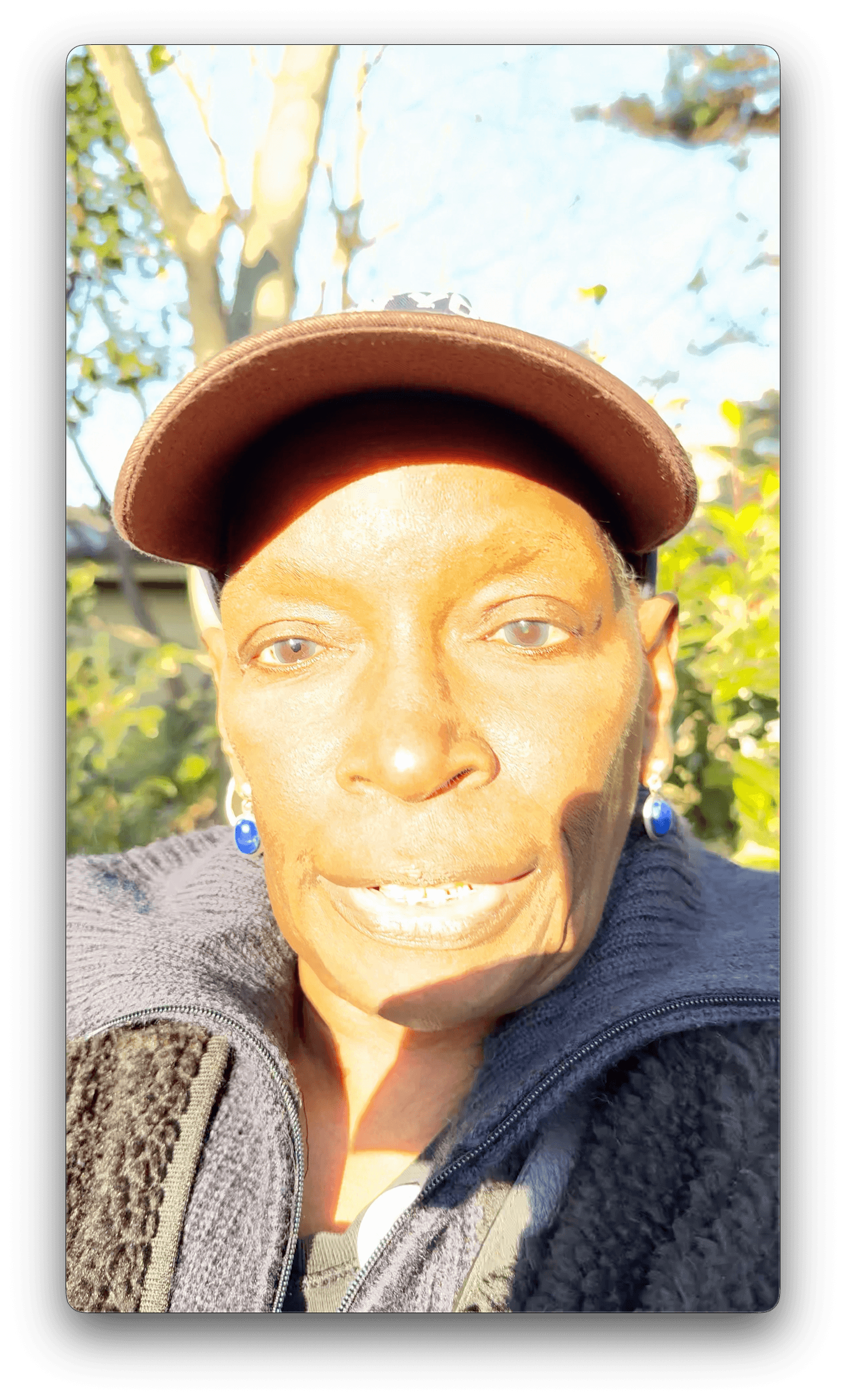 Terri with bald head due to chemo